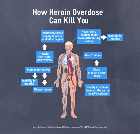 herion|what is heroin toxicity.